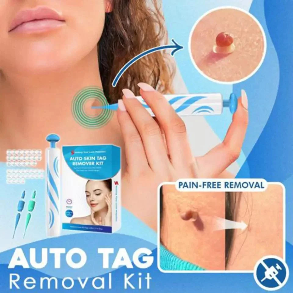 Kit pentru îndepărtarea alunițelor - elimină alunițele de piele