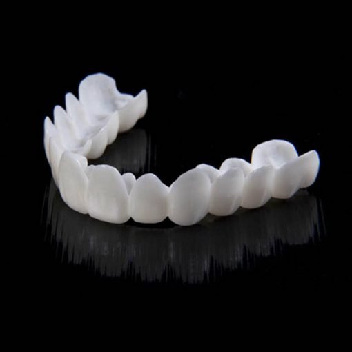 Snap on Smile Veneers (Ober- & Unterkiefer)