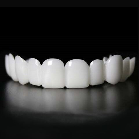 Snap on Smile Veneers (Ober- & Unterkiefer)