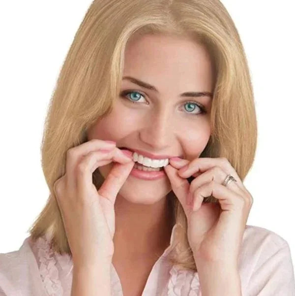 Snap on Smile Veneers (Ober- & Unterkiefer)