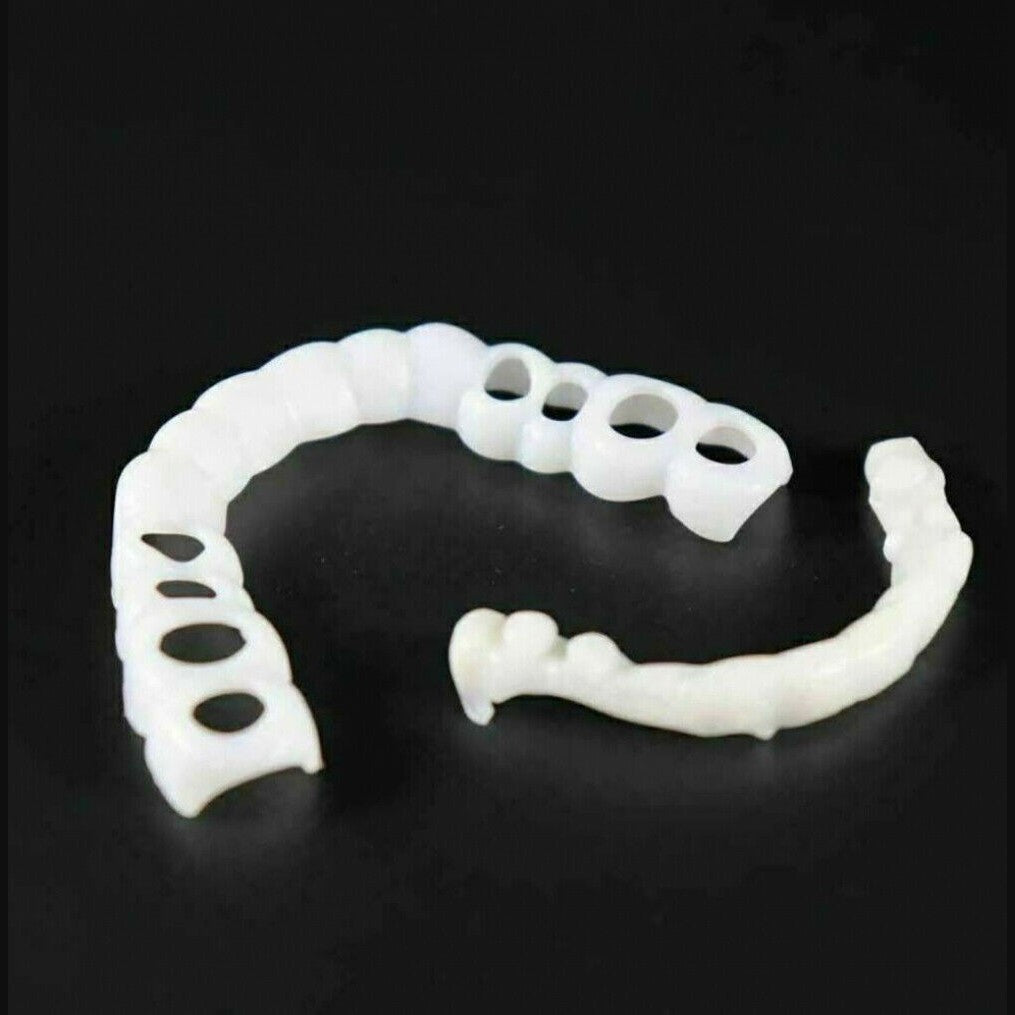 Snap on Smile Veneers (Ober- & Unterkiefer)