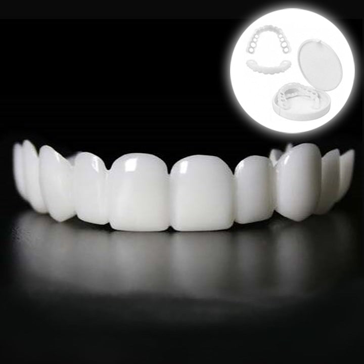 Snap on Smile Veneers (Ober- & Unterkiefer)